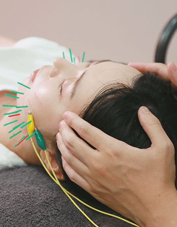 《リフトアップ＋お疲れの身体に★》美容鍼 60分＋整体 40分